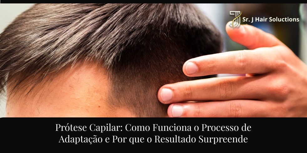 Adaptação à Prótese Capilar: O Que Esperar?