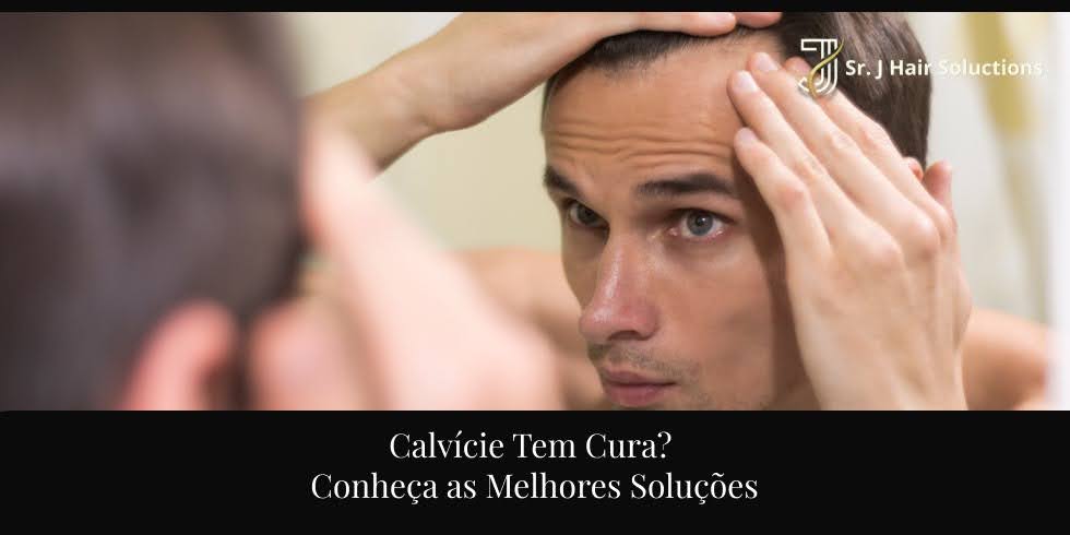 Calvície Tem Cura? Conheça as Melhores Soluções