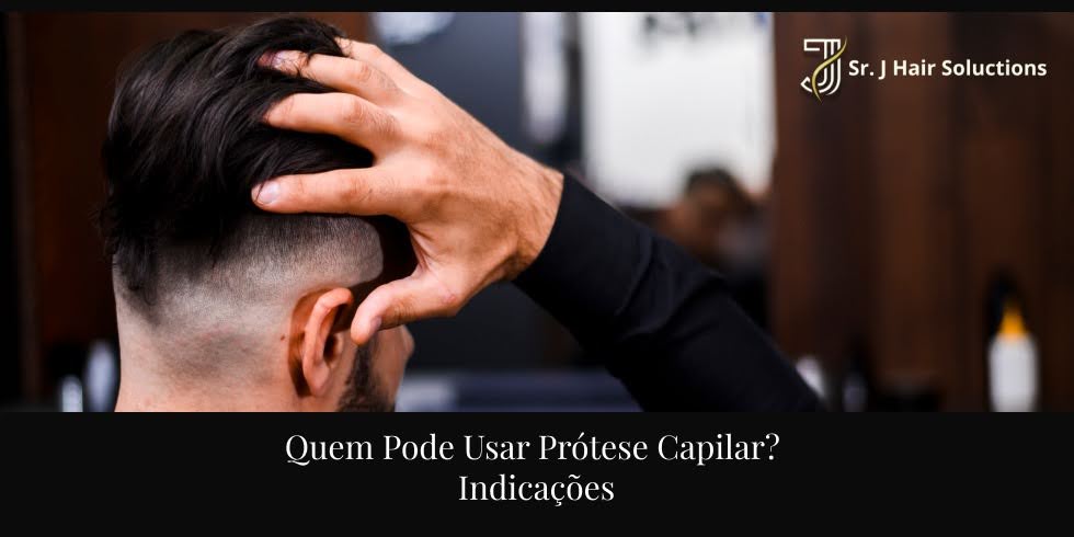 Quem Pode Usar Prótese Capilar? Indicações
