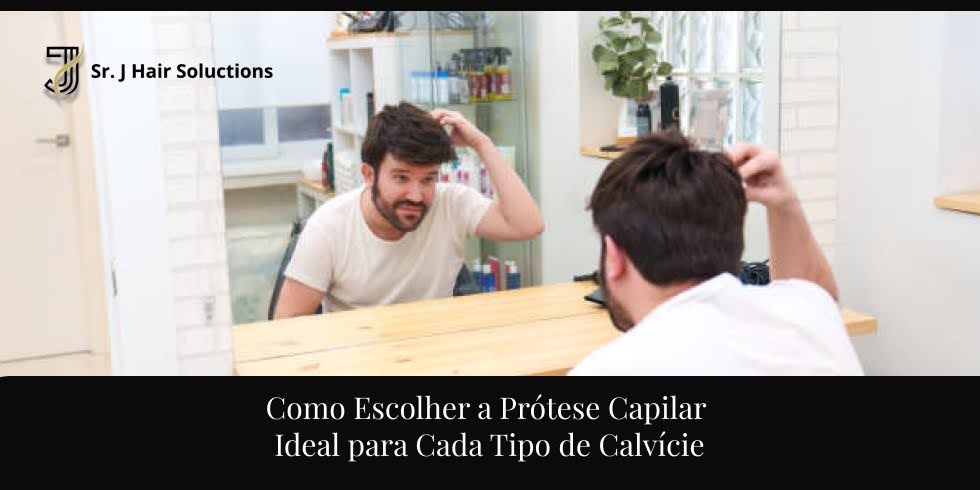 Como Escolher a Prótese Capilar Ideal para Cada Tipo de Calvície